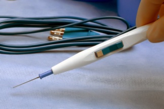 gallery/provedenie-radiovolnovoi-koagulyacii