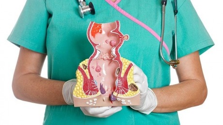 gallery/chto-takoe-gemorroy