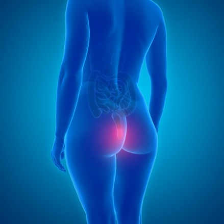 gallery/internalhemorrhoids01